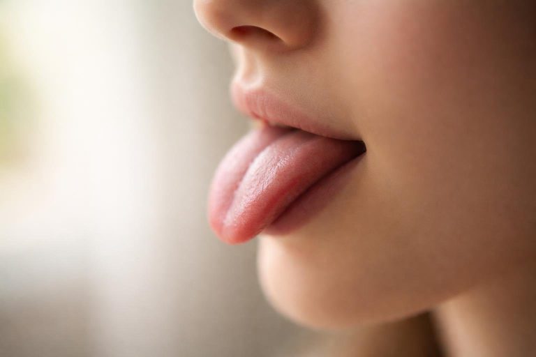 Bouton Blanc sur la Langue : Causes et Que Faire ?